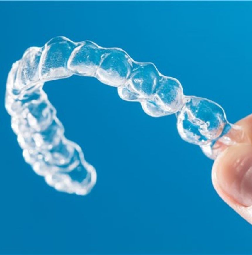 Image orthodontie invisible clinique dentaire du lac